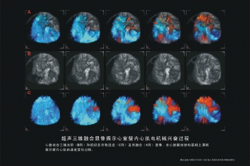 心肌电机械兴奋过程