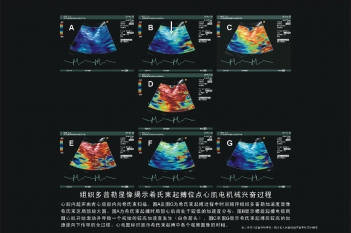 希氏束起搏位点心肌电机械兴奋过程
