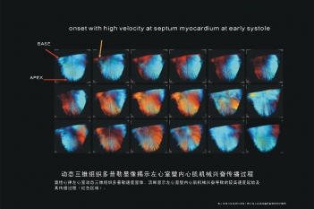 左心室壁内心肌机械兴奋过程