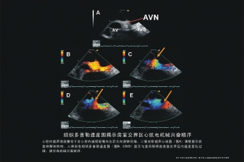 房室交界区心肌电机械兴奋顺序