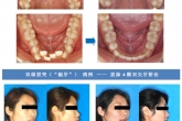 个性化正畸治疗