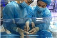 崇州分院新生儿病区成功开展首例PICC置管术