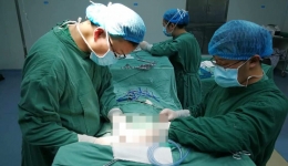 崇州分院乳腺甲状腺外科成功切除一例巨大甲状腺肿瘤