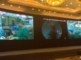 手术室顺利配合神经外科学术会议手术演示