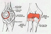 关节腔穿刺灌注治疗骨关节疾病