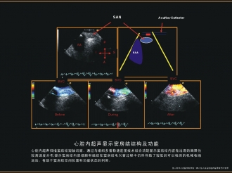 窦房结结构及功能