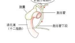 梗阻性黄疸