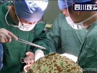 四川观察：省医院完成全国首例网络调配心肺移植手术
