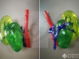 机器人微创中心应用3D打印模型助力高难手术