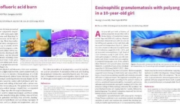 皮肤病性病研究所疑难罕见皮肤病临床诊疗研究上新台阶