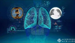 我院放射科人工智能肺结节筛查软件上线试运行