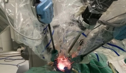 机器人微创中心完成西部首例后腹腔入路机器人单孔肾切除术