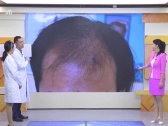 20201019：“头”等大事让人恼