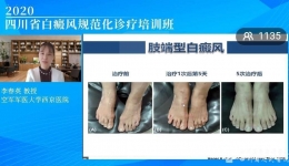 皮研所组织全省白癜风规范化诊疗培训