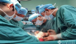 我院指导绵阳市中心医院完成川西北首例自体肝移植手术