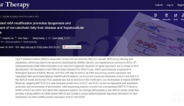 我院非酒精性脂肪性肝病研究成果在Molecular therapy发表