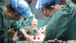 自体脾动脉移植术让晚期胰腺癌患者重获新生