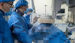放射科介入中心完成全国首例腹主动脉腔内冲击波治疗