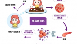 胰岛素抵抗，你了解吗？