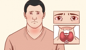 甲状腺眼病有了新疗法！