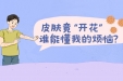 年轻人高发，这种“浪漫”的皮肤病，你偶遇了吗？