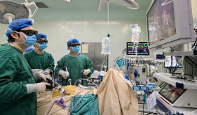 张宇主任团队成功完成全腹腔镜下罕见反位肝门胆管癌根治术