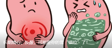 长期烧心、反酸,可能是你的胃“错位”了!
