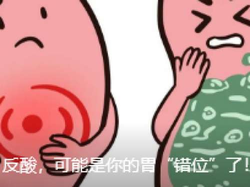 长期烧心、反酸，可能是你的胃“错位”了！
