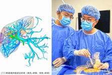 西南首例！超声医学科介入超声诊疗中心成功开展经皮超声引导纳米刀+腔镜超声引导微波消融治疗肝癌