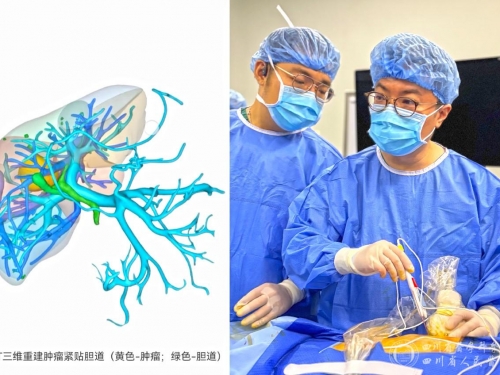 西南首例！超声医学科介入超声诊疗中心成功开展经皮超声引导纳米刀+腔镜超声引导微波消融治疗肝癌