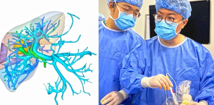 西南首例！超声医学科介入超声诊疗中心成功开展经皮超声引导纳米刀+腔镜超声引导微波消融治疗肝癌