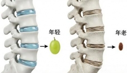 人老了，真的会“缩水”吗？脊柱外科医生揭秘：这4种情况要当心！