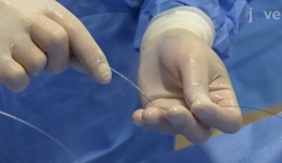 纤维性纵隔炎肺静脉狭窄介入治疗